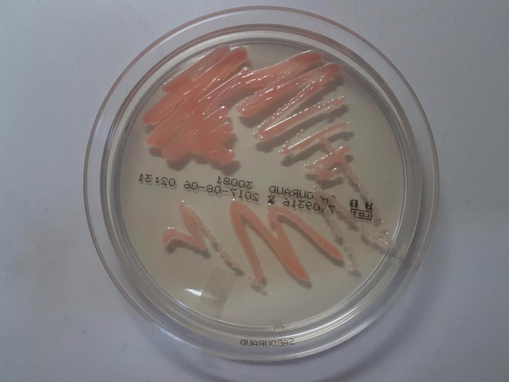 We prevent sepsis with our rapid diagnostic biosensor. Please see the last report on sepsis and what we are working on to solve.
'Alarming' one in five deaths due to sepsis
bbc.com/news/health-51………
#antibiotics #infection #health #treatment #sepsis 
<a href="/liaonet/">Bill Liao ☯</a>
<a href="/SOSV/">SOSV - Deep Tech for Human and Planetary Health</a>
<a href="/RebelBio/">RebelBio</a>