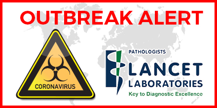 OUTBREAK ALERT!

The World Health Organization has informed us of a new virus that has broken out worldwide. The Novel Coronavirus. 
bit.ly/2TW7Z4Z