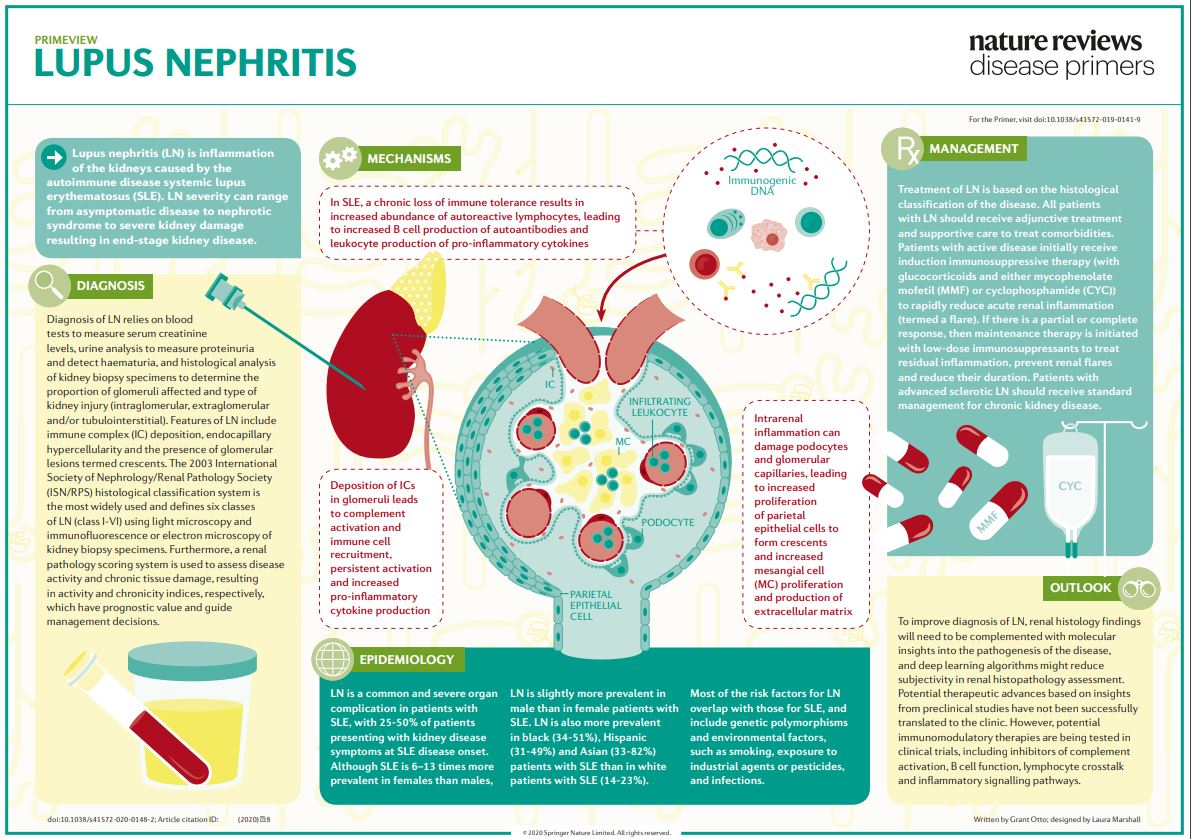 PrimeView of Lupus nephritis