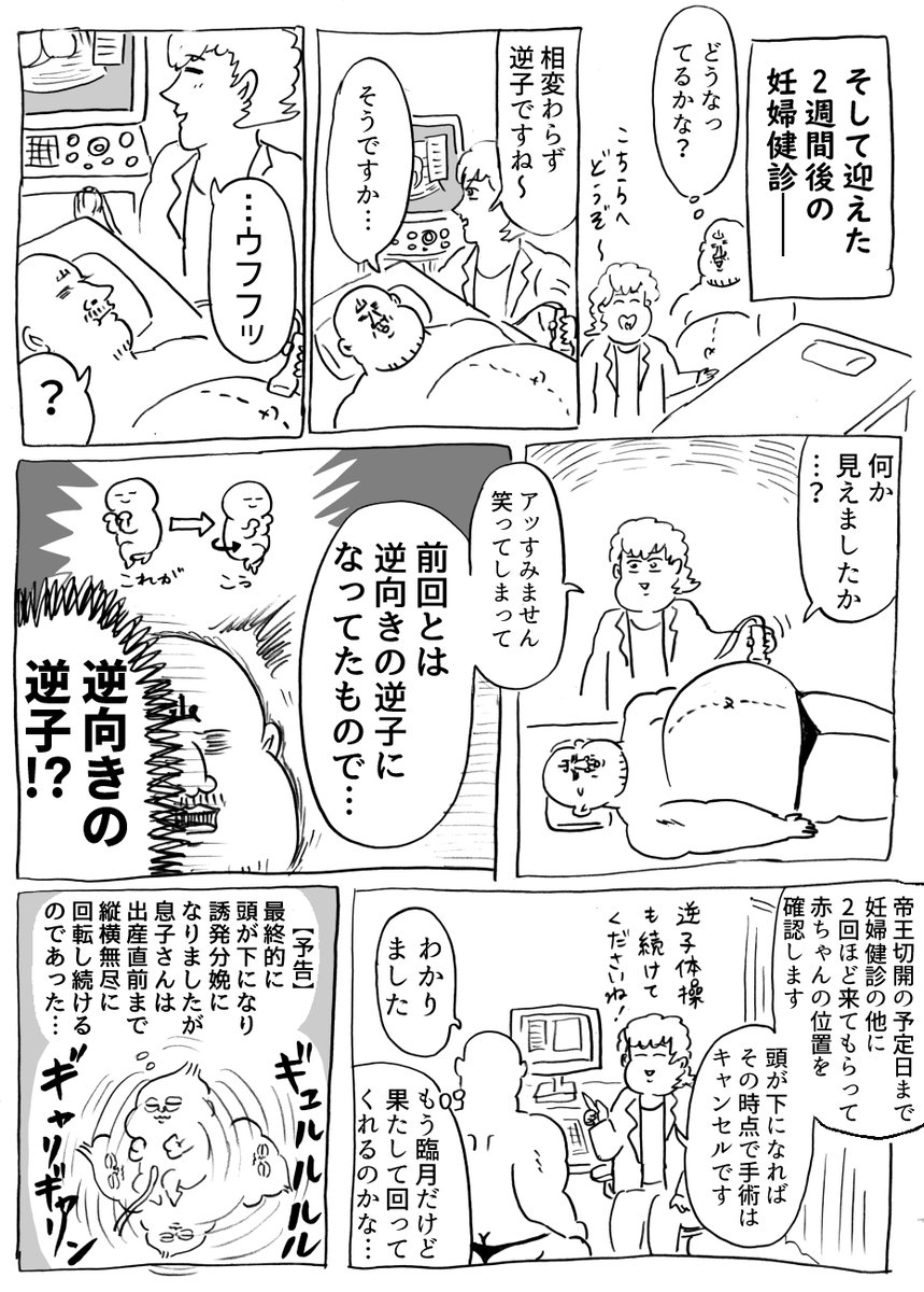 第二子出産レポその1～逆子・序章～ (漫画3P) 