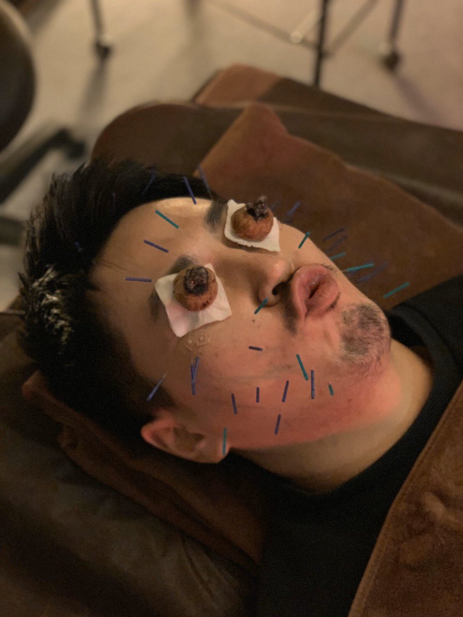 クルミ灸 クルミ灸