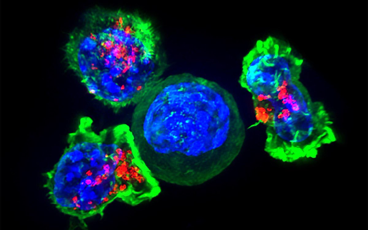 🧬 Se descubre un nuevo tipo de ‘killer T-cell’ equipado con un nuevo tipo de receptor capaz de reconocer y matar la mayoría de células cancerígenas e ignorar células sanas. Potencial tratamiento universal anti-cáncer. <a href="/NatImmunol/">Nature Immunology</a> #Immunotherapy 

🧪 nature.com/articles/s4159…