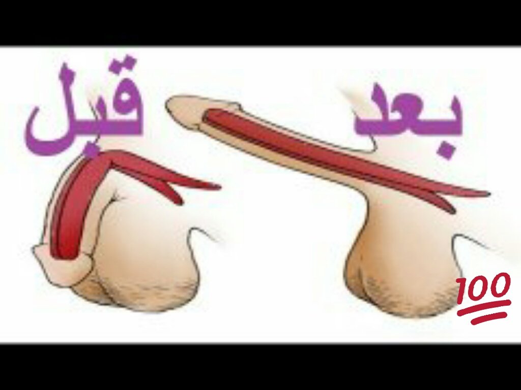 txiiiddj's tweet photo. #قٌٌٌٌٌابوٍٍٍس_فْي_ذٌٍِمه_الٌله

💃مجموعة تكبير القضيب❤💃 

💋💑علِاج ضعِف الانتصاُب💋💃

💥 تـَــأخِيـــَــــرْ القـَــــْــذِفْ 👏🍁 

👍💥 30  دَقِِــيِـــَقــَــــــَـــــَــة ✅💢
#الباٌٌٌحة_الاٍٍُُن
📲للطلب رابط الواتس باول تعليق https://t.co/C75a46fzA5