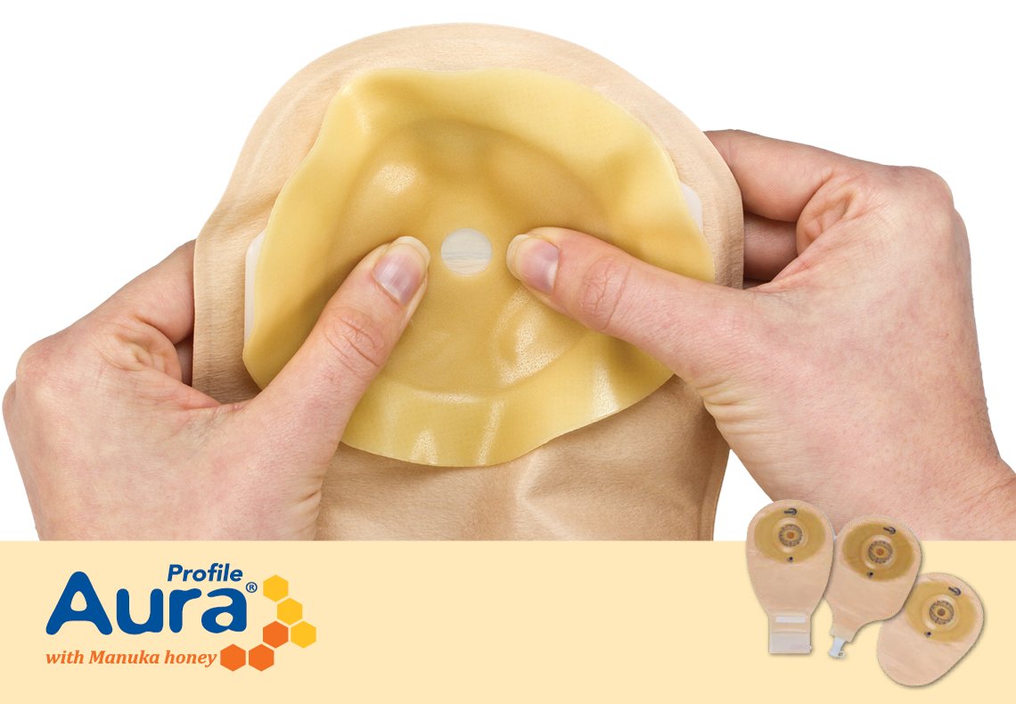 SecuriCareHDS's tweet photo. Struggling with a parastomal hernia? For a secure, leak-free fit, try Aura Profile. Visit https://t.co/PMZPcTtC6D and see if it can resolve your struggles. #stoma #stomaproblems https://t.co/6wDbQ2MYg8