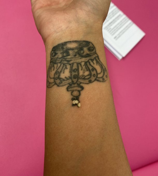 Skin Test: ready for Laser tattoo removal 😁 this tattoo I&rsquo;ve wanted to remove for many years, finally
