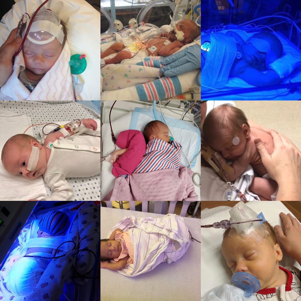 allofound's tweet photo. These nine babies wouldn’t be here without #blooddonation.
During #nationalblooddonor month we challenge everyone with three things:
Be a donor. Inspire a donor. Thank a donor.
#thankyoudonors #savelives #alloimmunization #kell #isoimmunization #antiD #rhdisease #nicu https://t.co/6lg9RlRdLF