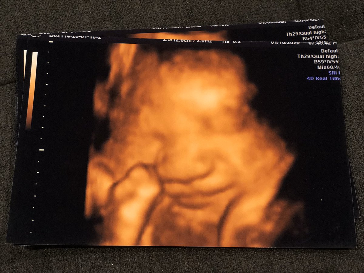 jilpinedaa's tweet photo. Ok baby we all ready to meet you 🥺💗 https://t.co/9M3B1n6FsY