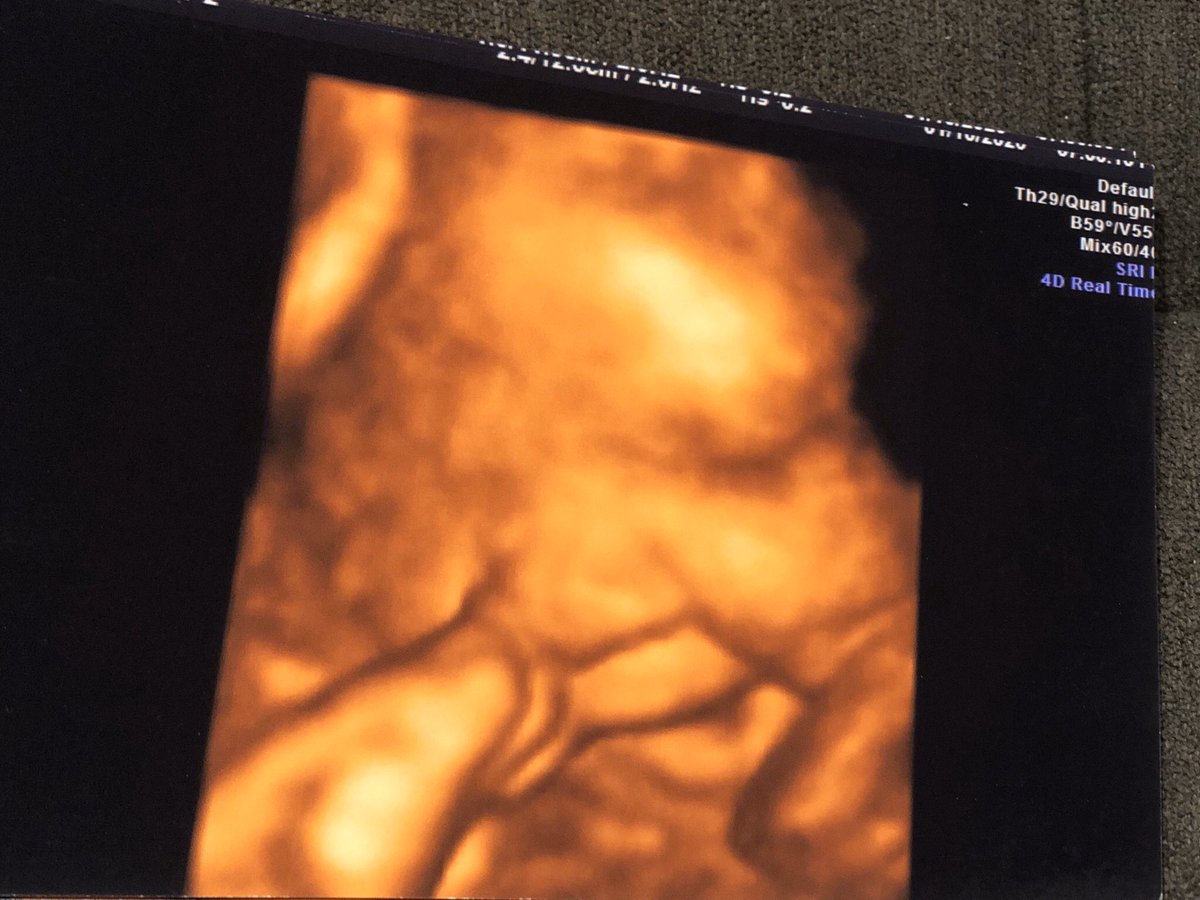 jilpinedaa's tweet photo. Ok baby we all ready to meet you 🥺💗 https://t.co/9M3B1n6FsY