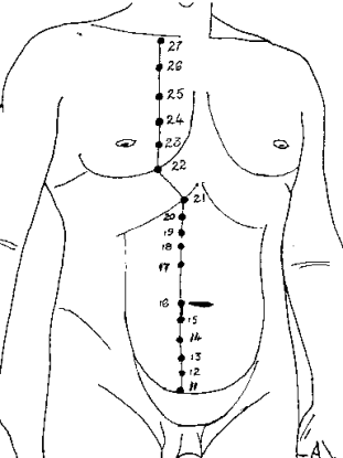 kyusho_alliance's tweet photo. Learn everything there is to know about Deadly Pressure Point KD-21 - The heart Stop Pressure Point . One of the most devastating Combat Pressure Points #kyusho #dangerouspressurepoints #combatpressurepoints #deadlypressurepoints #martialarts https://t.co/MXEyriIkhV https://t.co/uOCjE20JuF