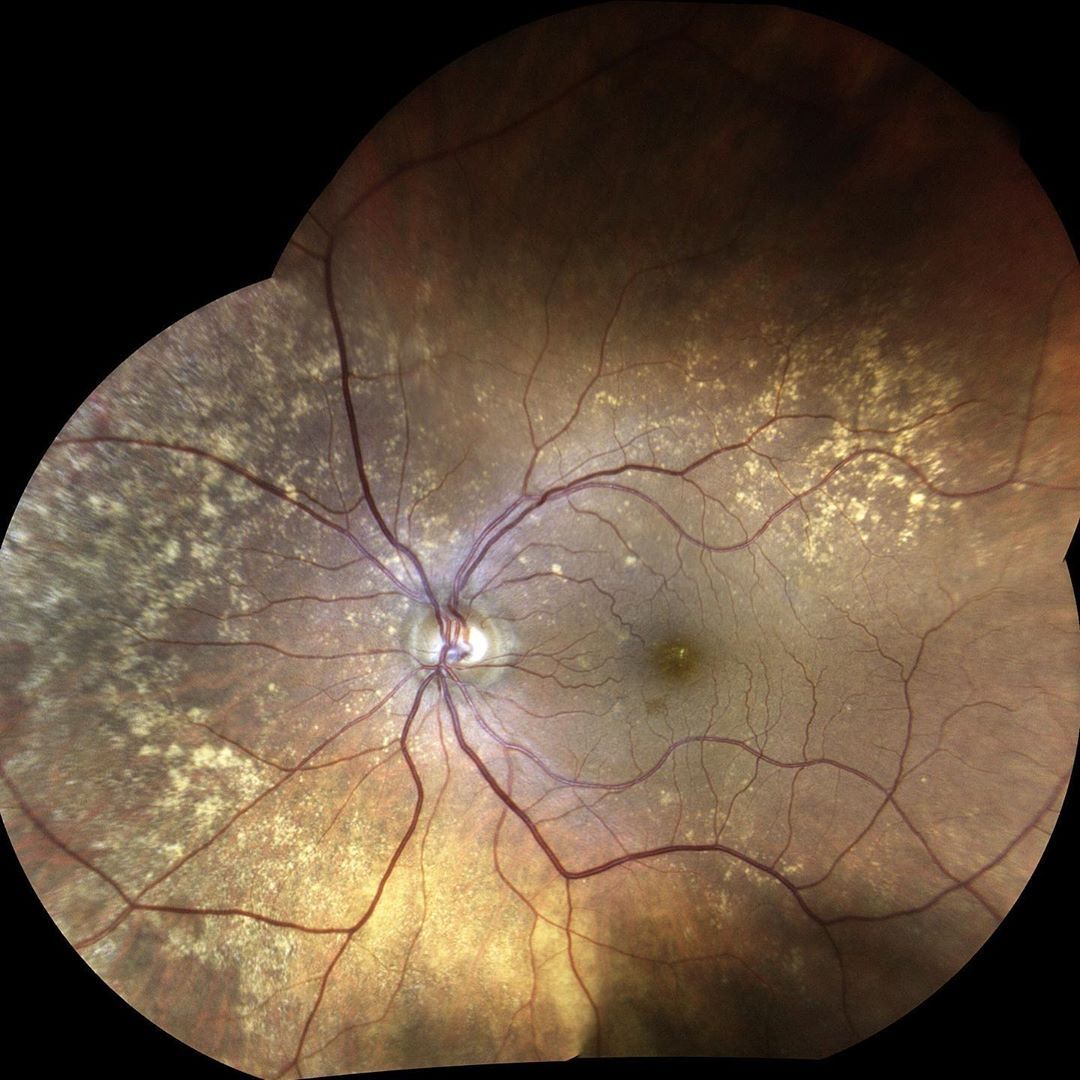 CENTERVUE tweet media