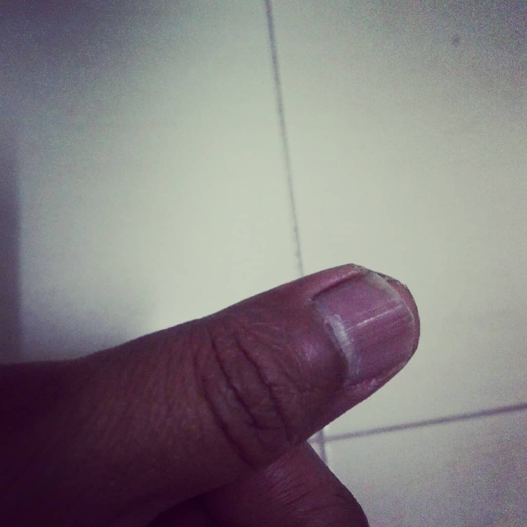 Irwan On Twitter Main Gitar Biasanya Jemari Kiri Je Kematu Ni Sampai Ibu Jari Kanan Pun Dah Sumpik