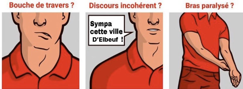 svdgang's tweet image. Comment reconnaître un AVC?