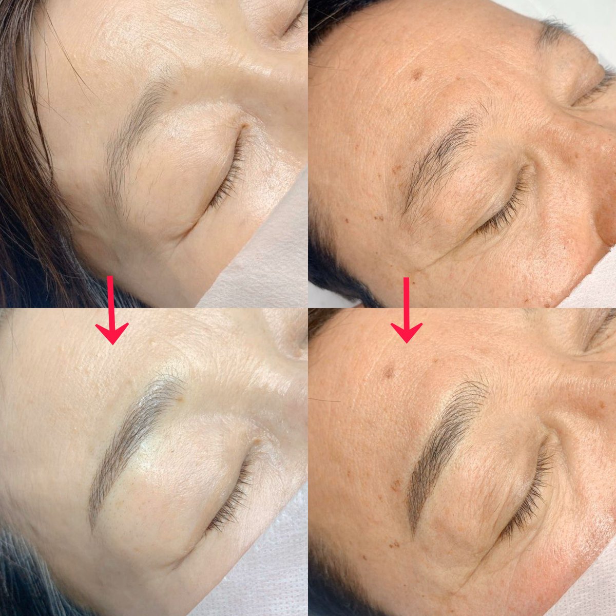 アートメイク Brownee A Twitter 年齢を重ねるごとに眉毛は薄くなり なかなか思い通りの眉毛 を描けないお客様が多くいらっしゃいます 男性も女性も眉毛アートで綺麗でナチュラルな眉毛に仕上げ 印象もはっきりとした童顔効果のある眉毛に仕上げております