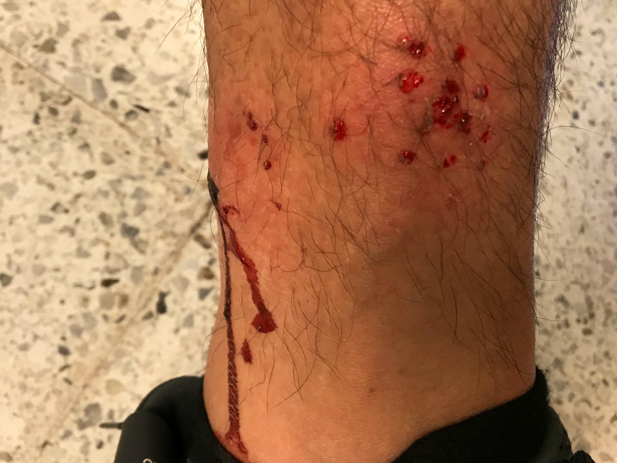 CareTrece tweet media