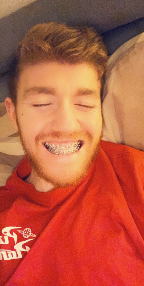 glenn_hanlon's tweet photo. It’s yo boi Glenn with the new smile 🙈😁🦷 https://t.co/CoM3LRcYyS