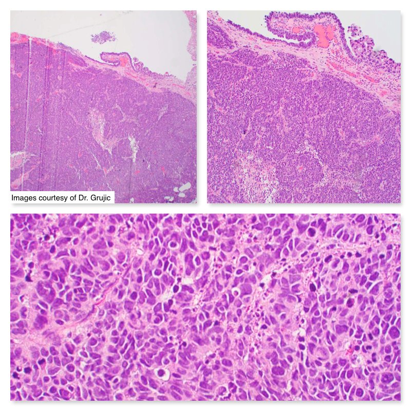 South Bay Pathology tweet media