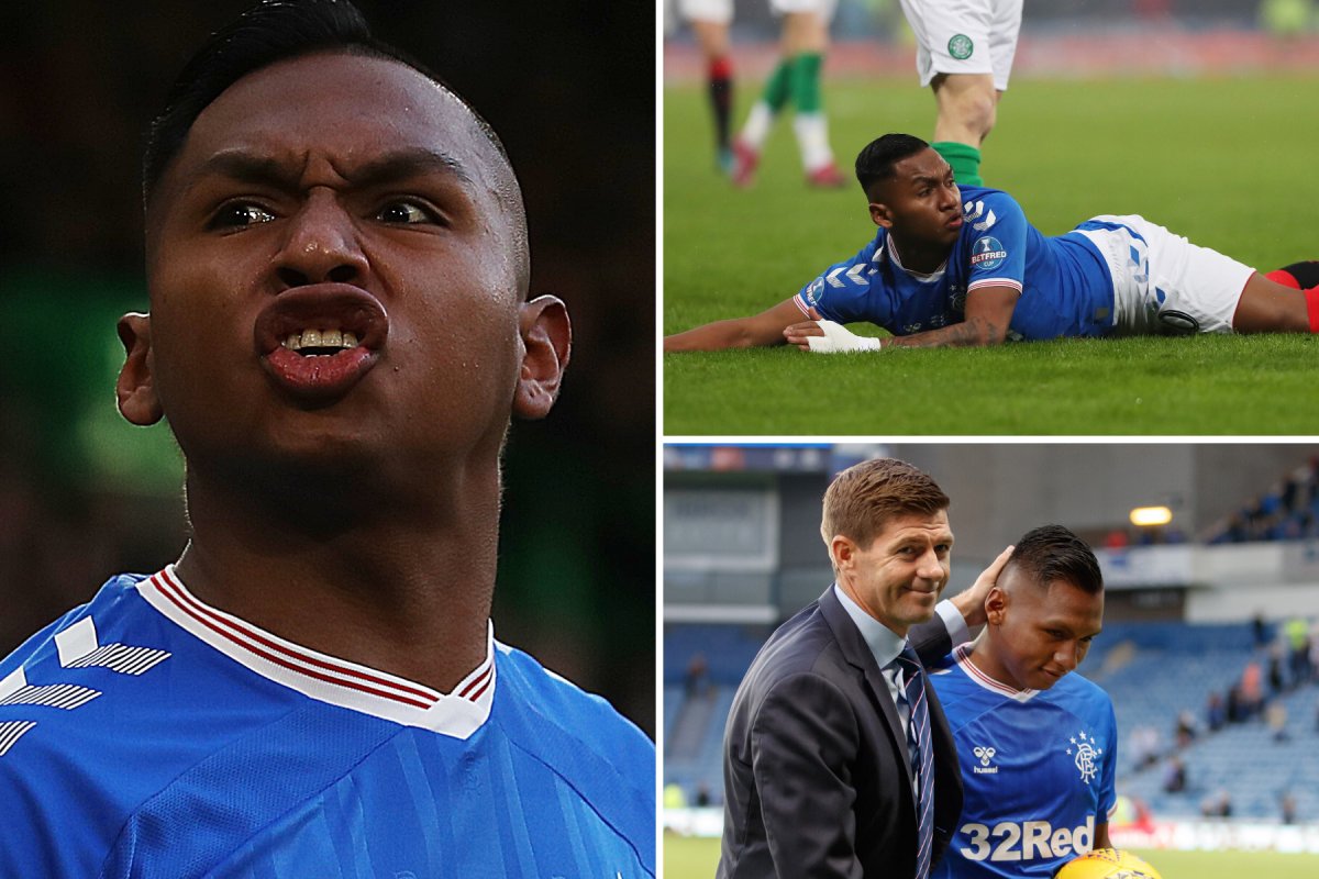 scotsunsport's tweet photo. 🗣 "A waster? Yes, for me that’s what the Rangers striker is."

Alfredo Morelos spoils much of his good work by slouching around like a miserable, spoiled, angry brat who hates his job, says Bill Leckie ✍️

https://t.co/rSBSygy64P https://t.co/bZiEJMB7sn