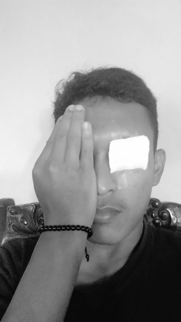 Iki mataku, matamu piye ???