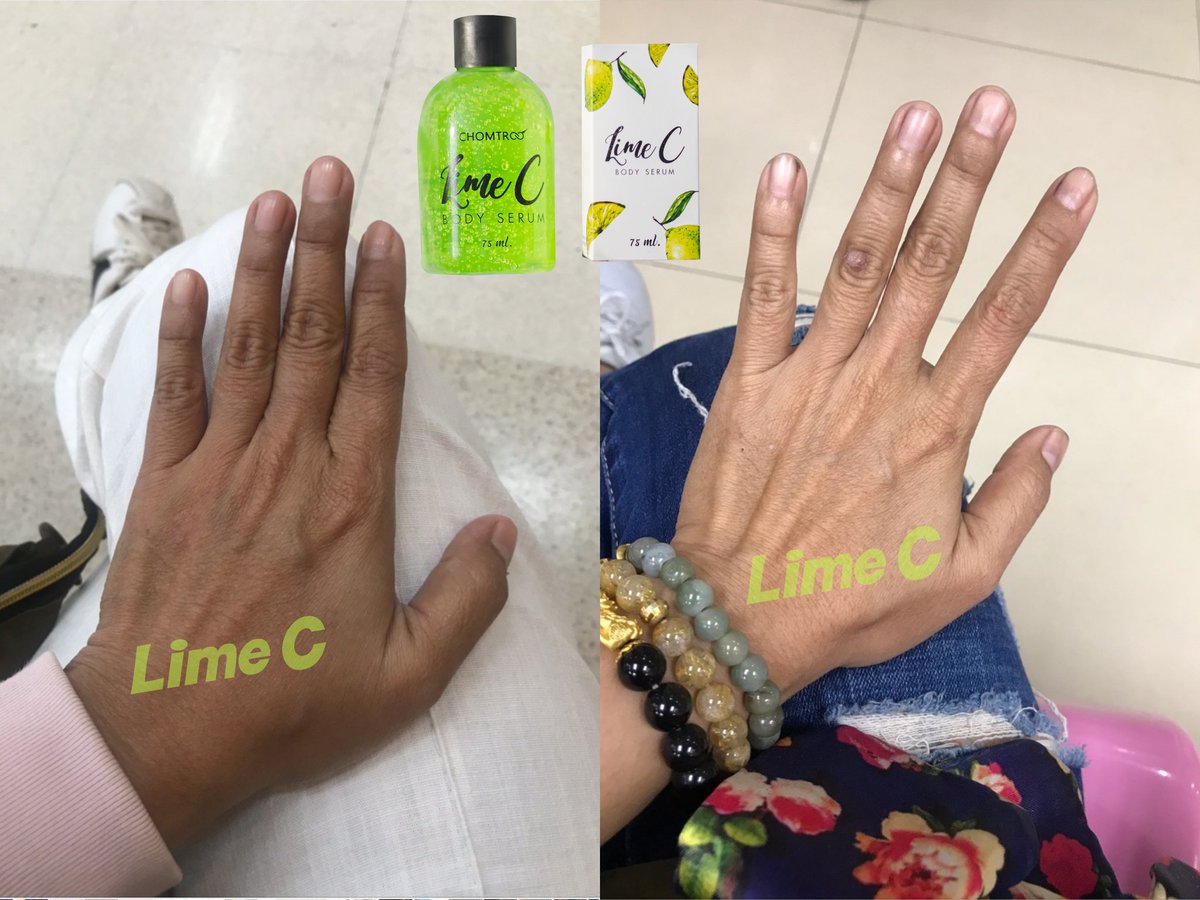 SoapNun's tweet photo. เซรั่มน้ำหอมทาผิวกาย #LimeC
ขวดละ 129.- ขนาด 75ml.
#อยากผิวขาว #ตัวหอม #ผิวเนียน
สั่งเลย ID:nun_cartoon https://t.co/52E2uacjVC
