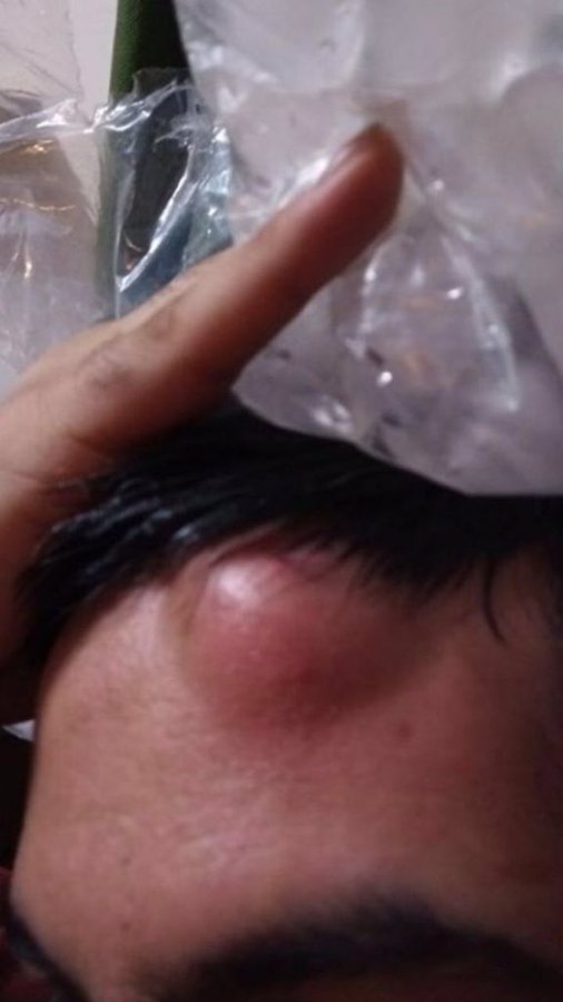 مشاهده عکس در توییتر