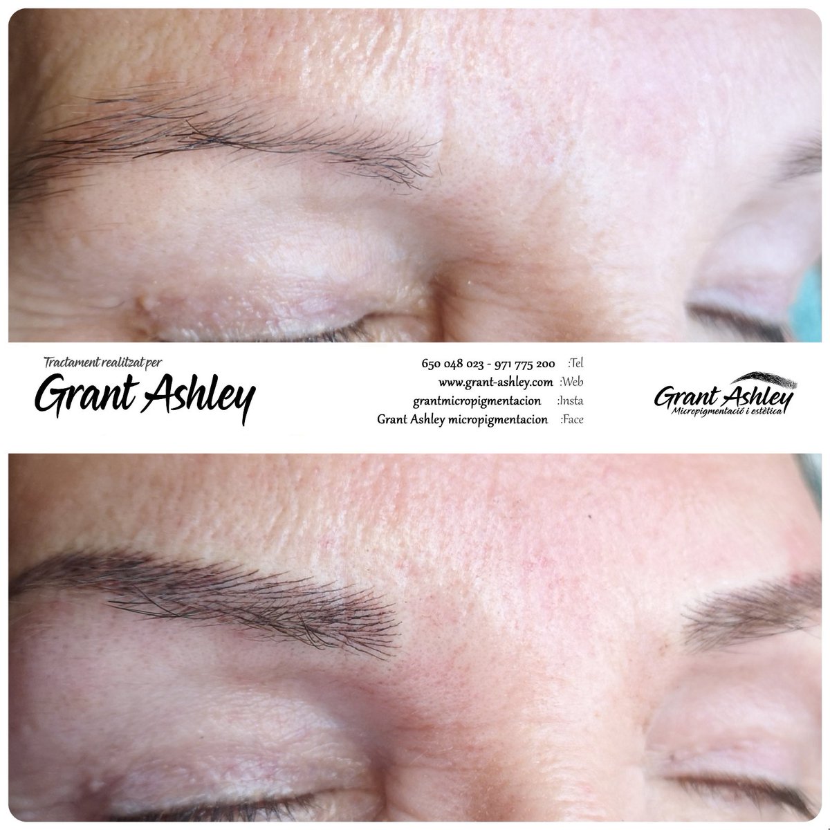 grantmicro's tweet photo. Resultats de micropigmentació amb en Grant Ashley al centre Grant Ashley a Inca. Mes info 650048023
#microneedling #grantashley #incaciutat #estetica #beauty https://t.co/p07l4Q4nSy