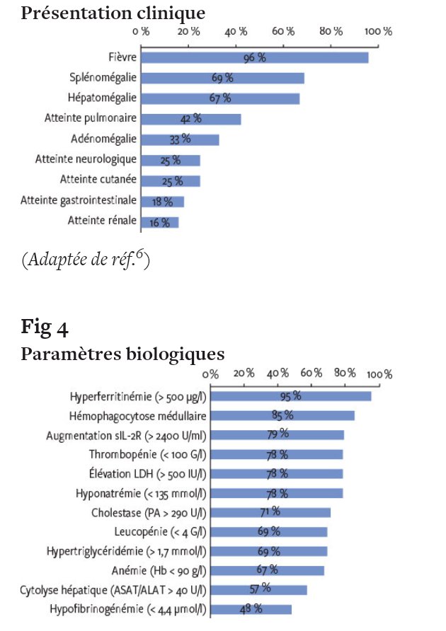 whoswise's tweet photo. #CATdevant Sd d'activation macrophagique ou syndrome #hémophagocytaire(SH):1) Primaire (SHP)autosomique récessive et 2) réactionnel (SHR).Le ttt est 1)symptomatique : transfusion et hémostase. 2)Étiologique(infection) et 3)spécifique: Etoposide, transplantation cellules souches. https://t.co/3nLUSuN5sB