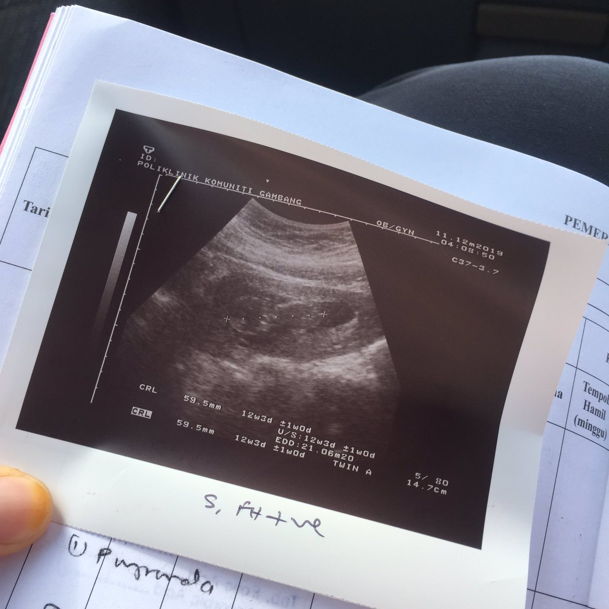 Bulan lepas check up, 13 weeks.
Now, 17 weeks.

Hi anak ibu 🥰