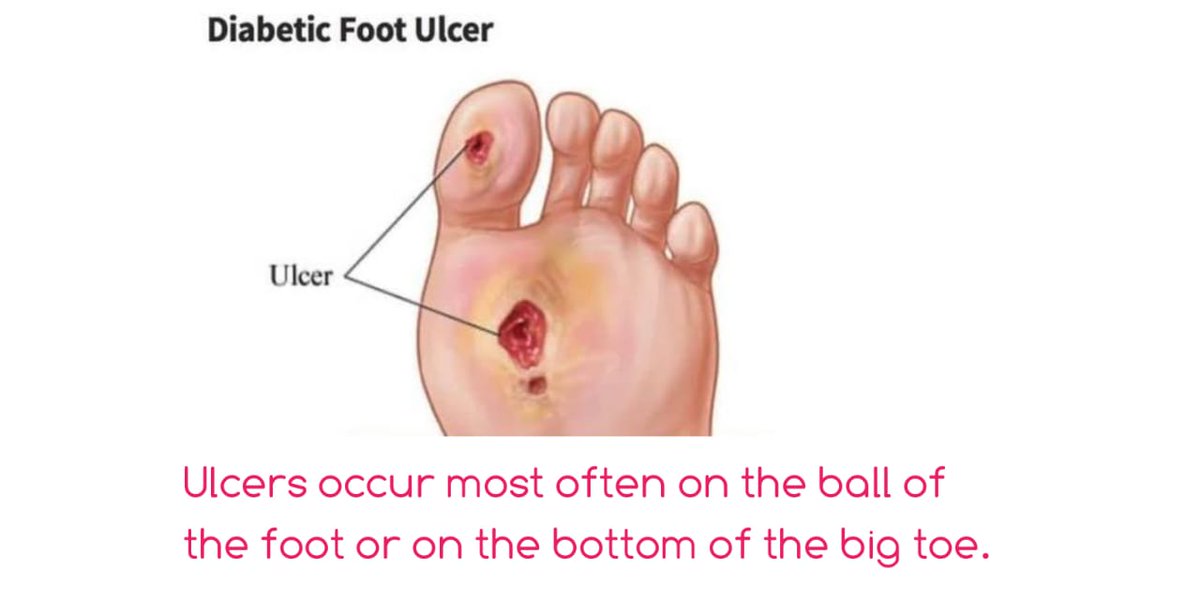 Bermuda Diabetes Association tweet media