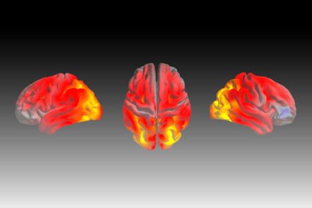 Only a week to go until the popular #MOOC Many Faces of #Dementia starts again! Sign up: bit.ly/2RkqKiq <a href="/RareDementia/">RareDementiaSupport</a> <a href="/createdhub/">Created Out of Mind</a>