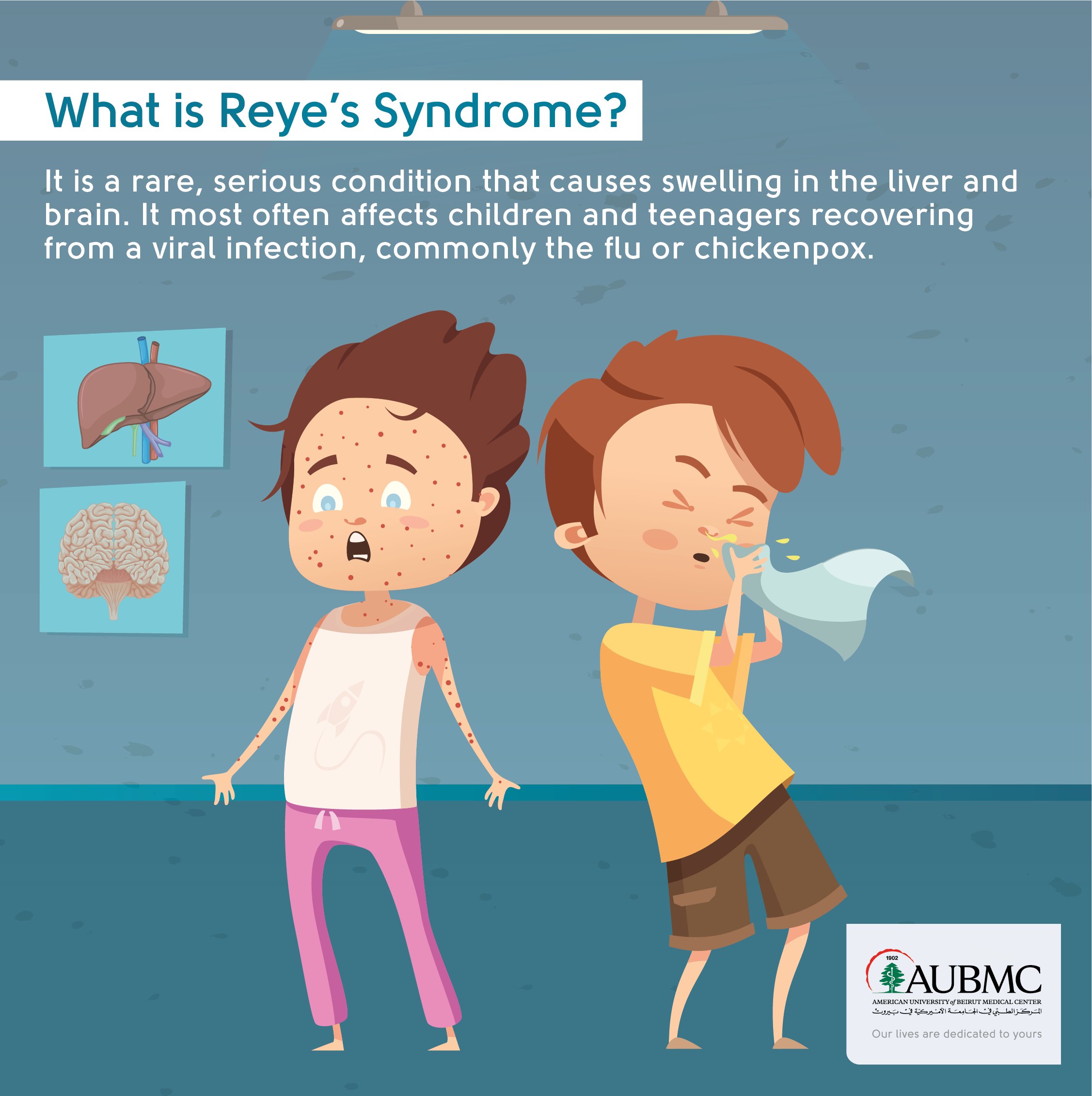 Reye syndrome