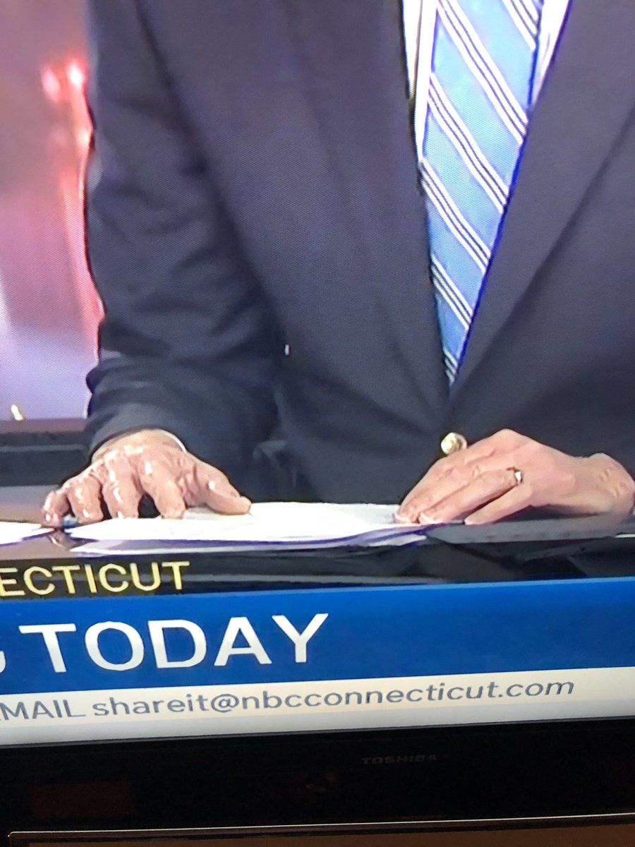 DoctorFreako's tweet photo. Why is #Teddles right hand so disproportionately shiny?!? @HeidiVoight @NBCConnecticut https://t.co/CNK9nZxxX3