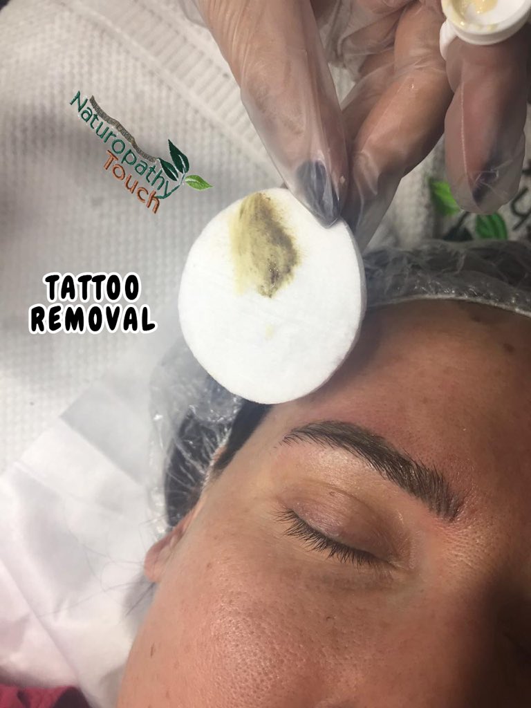 NaturopathyJLT's tweet photo. #Howtoremovetattoo #Tattooremovalcourse #Tattooremovallessons #Learntattooremoval
#permanentmakeupremoval #nanobladinglesson #nanobladingcourse #MarketingMicroblading #marketingpermanentmakeup #marketingcosmetictattoo #HairStrokesDrawTricks #HairStrokesTricks #LipsCosmeticTattoo https://t.co/tsB4csNnO9