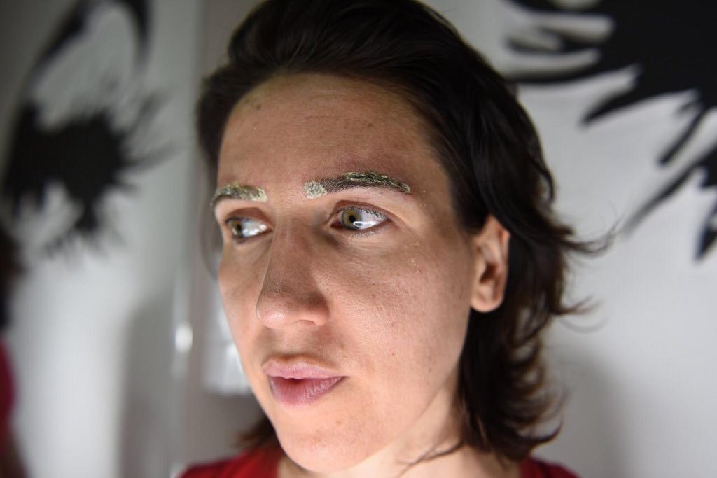 NaturopathyJLT's tweet photo. #Howtoremovetattoo #Tattooremovalcourse #Tattooremovallessons #Learntattooremoval
#permanentmakeupremoval #nanobladinglesson #nanobladingcourse #MarketingMicroblading #marketingpermanentmakeup #marketingcosmetictattoo #HairStrokesDrawTricks #HairStrokesTricks #LipsCosmeticTattoo https://t.co/tsB4csNnO9