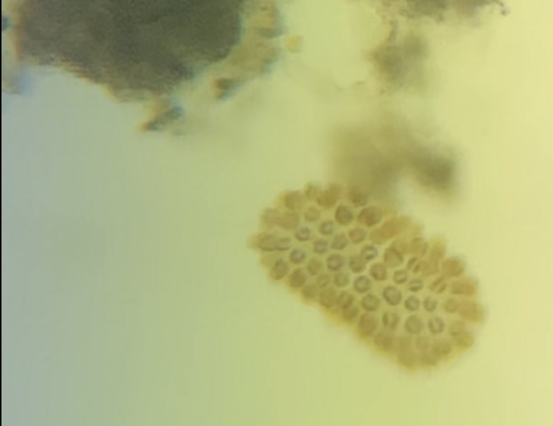 GerrittGriffith's tweet photo. This golden-brown algae is apart of the Synuraceae family. Each individual scale forms within special vesicles known as silica deposition vesicles derived from the Golgi complex. @CSHSGators @AmyDouglas318 #BiologyII6th #ThatScreenshotThough🥴 https://t.co/ST8OHRtKvu