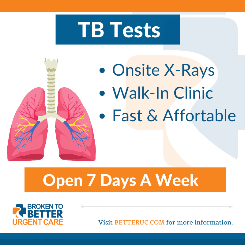 BrokenToBetter's tweet photo. Need a TB Test fast? Don't wait just walk-in to Broken To Better Urgent Care! http://bit.aly/Check-In-BrokentoBetterUrgentCare
...
#RockHilll #SouthCarolina #SC #UrgentCare #Walkin #Clinic #DrBaker #MedicalCenter #RockHillDoctor #BrokenToBetter #TB #TBTest https://t.co/RDZmOZq3KA
