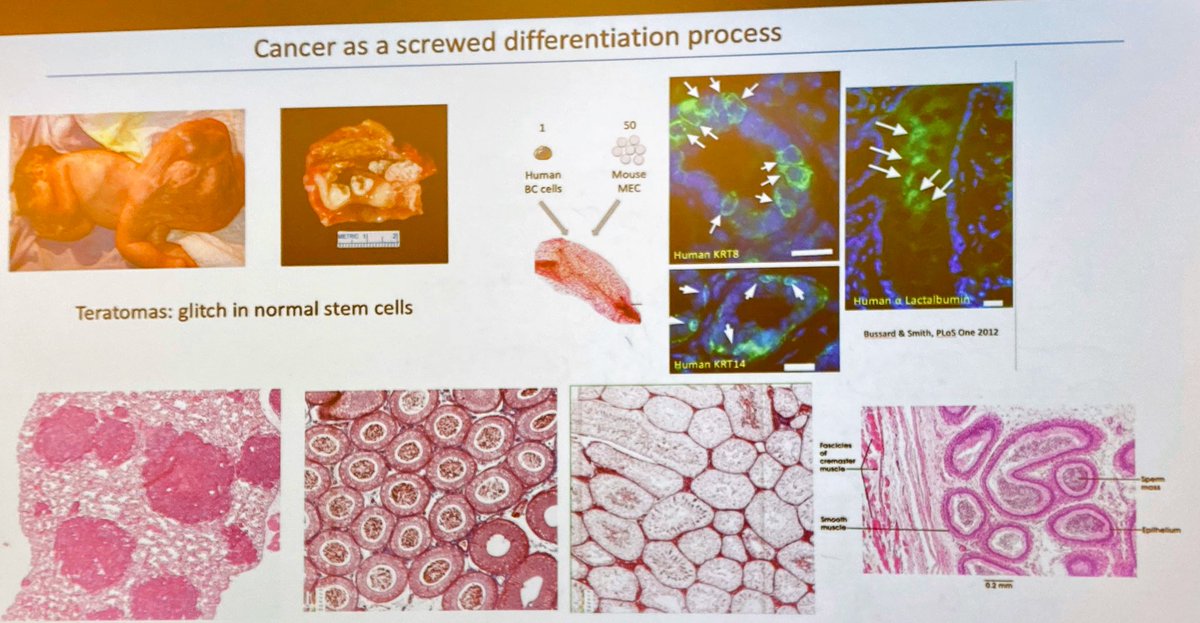 ara_anderson's tweet photo. .@AndriyMarusyk saysCancer shouldn’t just be viewed from the Darwinian perspective but also from a messed up differentiation paradigm #ThinkFest20 https://t.co/iEpbmXIw1r