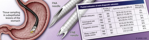 GIE (@gie_journal) on Twitter photo Check out “Comparison between fine-needle biopsy and fine-needle aspiration for EUS-guided sampling of subepithelial lesions” by Facciorusso et al from the January issue. ow.ly/CT0Y30q3MRi Check out “Comparison between fine-needle biopsy and fine-needle aspiration for EUS-guided sampling of subepithelial lesions” by Facciorusso et al from the January issue. ow.ly/CT0Y30q3MRi