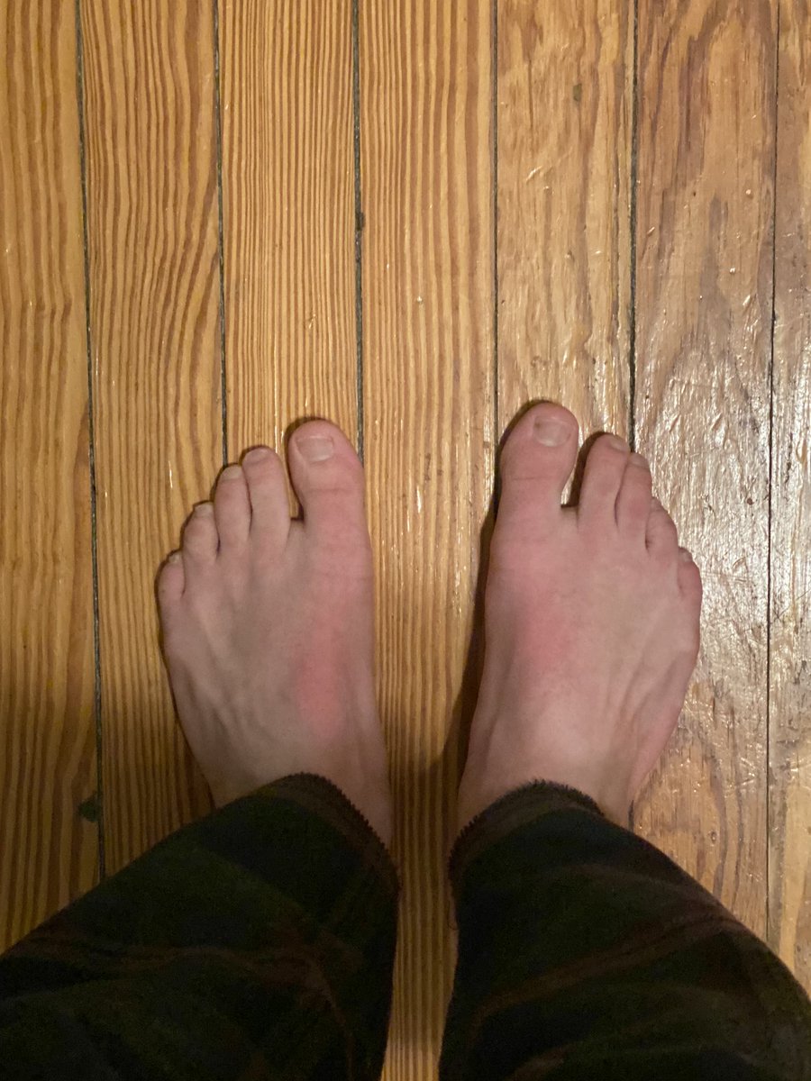 youngthor7's tweet photo. Drop your hard earned money right into my account #paypigwanted #cashslaveswanted #footslave #findomfeet #footfetısh #humanatm #cashfags #humanwallet #footgod #alpha #cashslave #cashmaster https://t.co/2QnfaiiTqn
