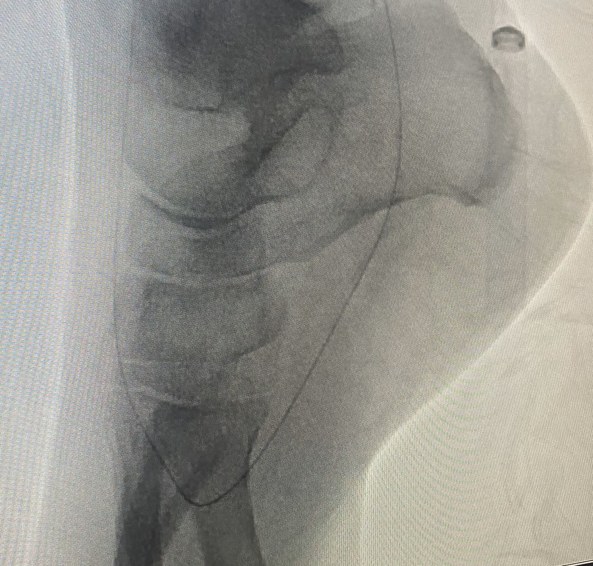 South Florida Vascular Specialists tweet media