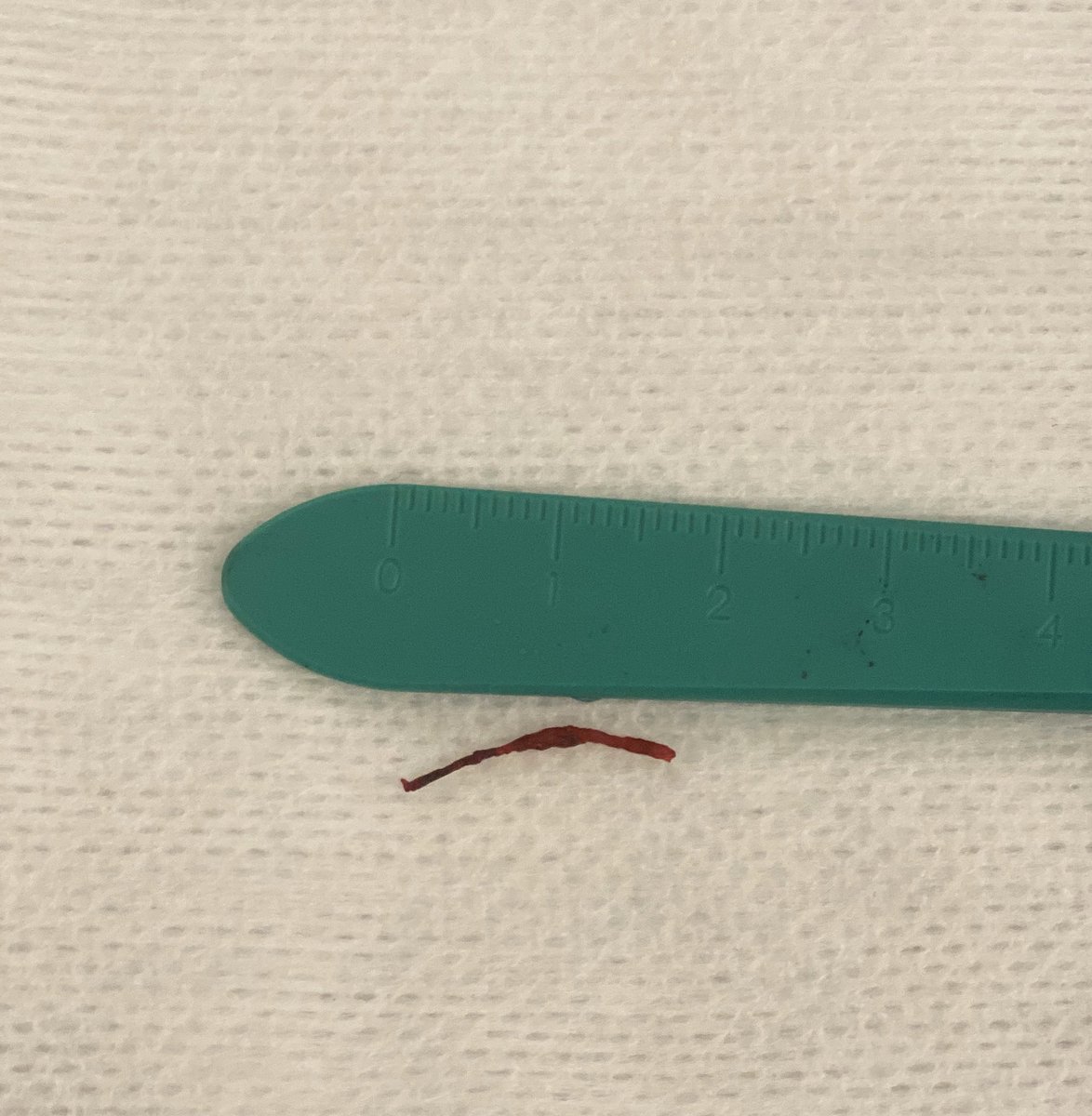 South Florida Vascular Specialists tweet media