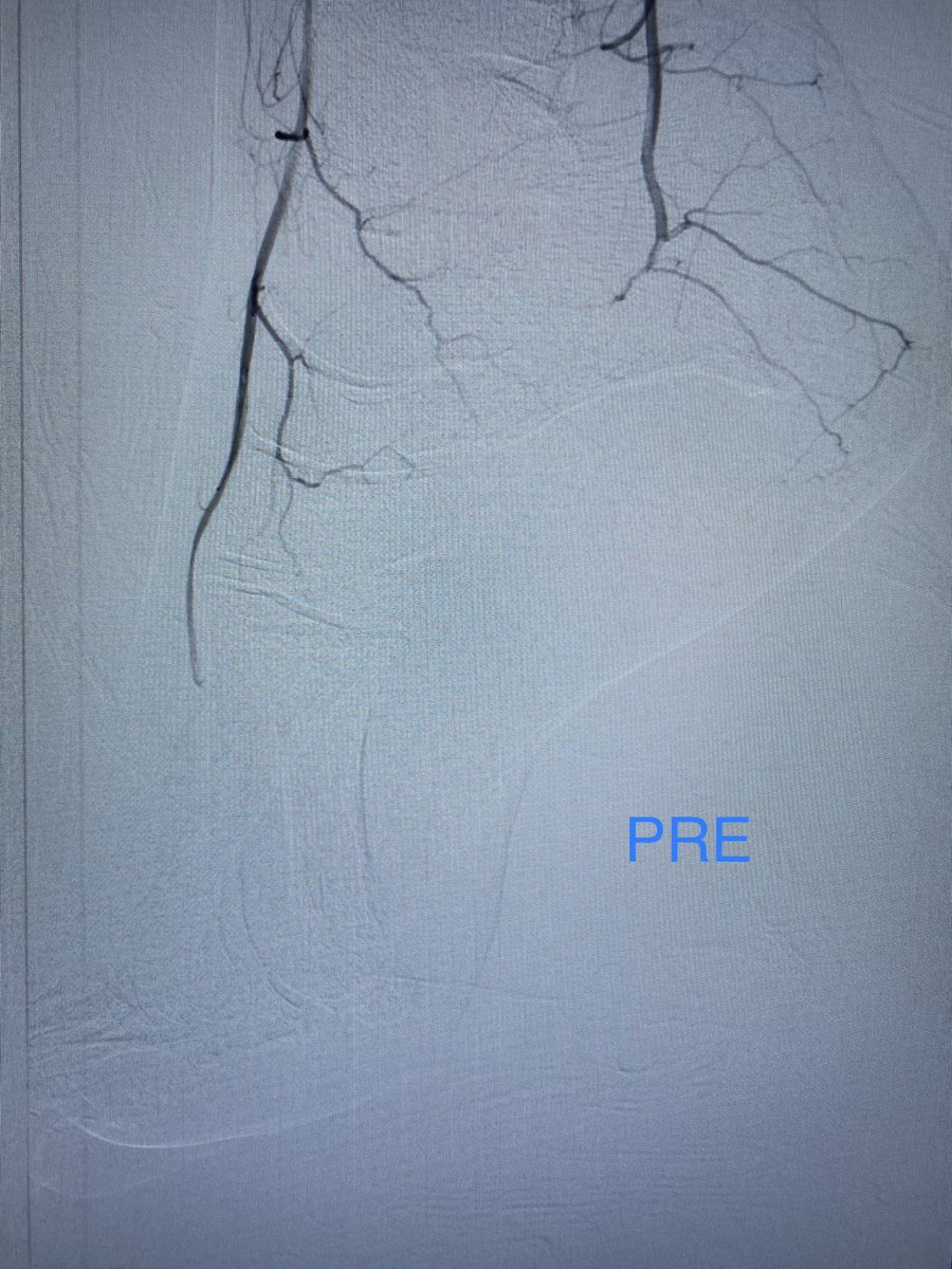 South Florida Vascular Specialists tweet media