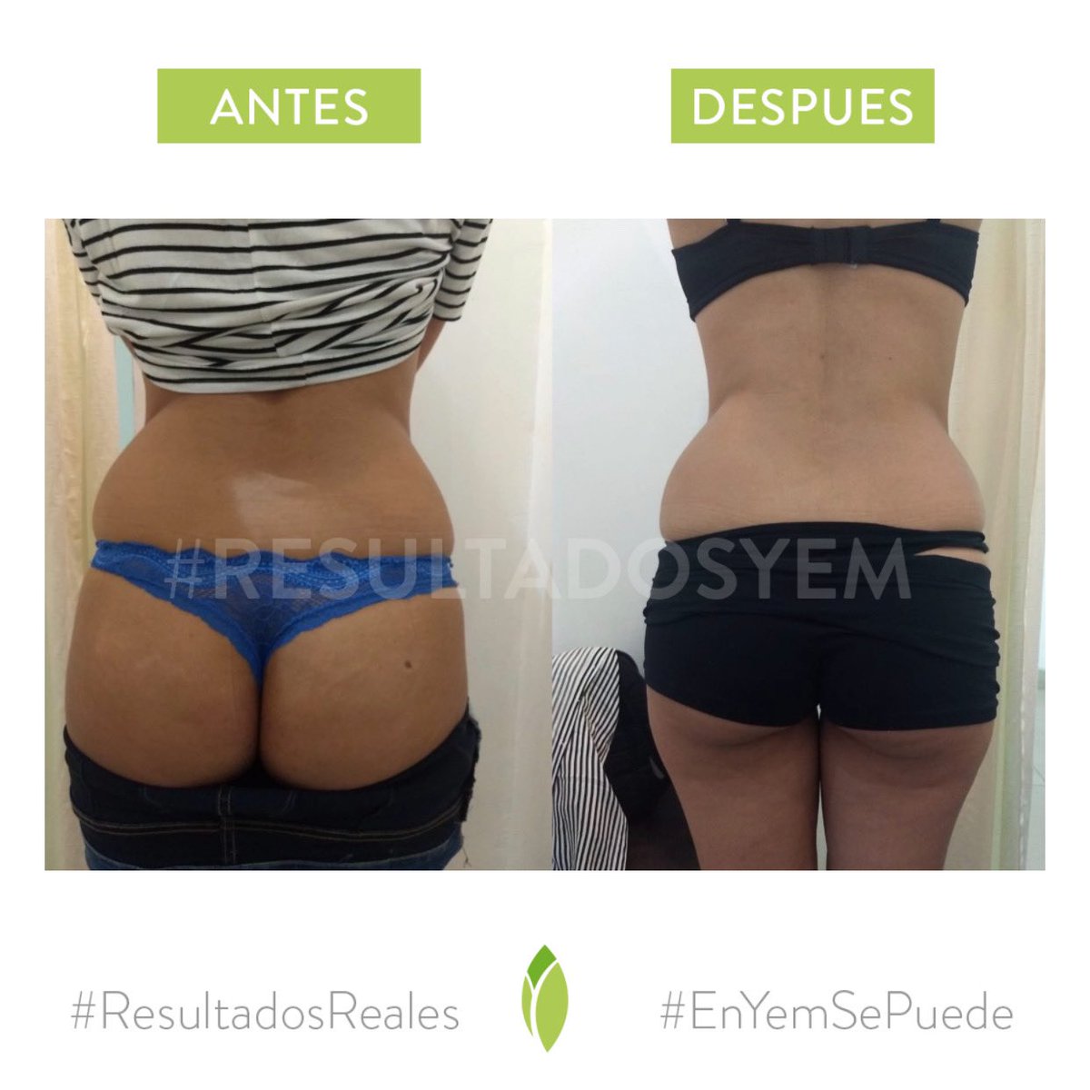Resultados de 2 visitas!
#EnYemSePuede 💪🏻