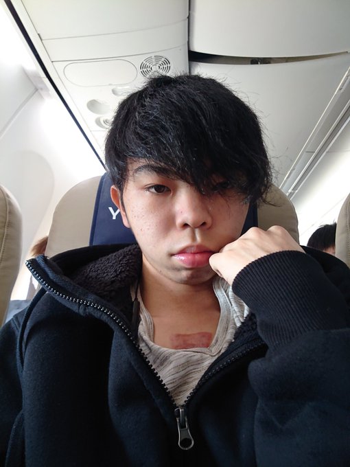 混沌さんの胸の傷は病気が理由 過去にいじめられていたのか