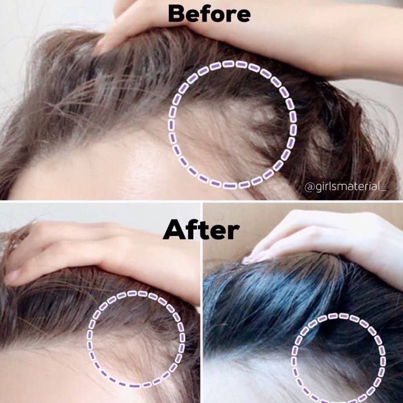 KK_store8's tweet photo. #cosshopsskin #พร้อมส่ง 
#Terapic Premium Total Hair Tonic Anti Hair Loss Care 150ml.  
🌈440฿
📮40/60
       สเปรย์ลดผมร่วง แก้ปัญหาผมบาง เป็นเซรั่มที่ช่วยให้ผมหนาขึ้น ผมร่วง ผมบาง 
วิธีใช้ : ฉีดลงบนศีร��ะ แล้วนวดๆให้ทั่ว มันจะเย็นๆหัวหน่อย สดชื่น

#howtobeauty #howtoperfect https://t.co/wFjSm9SGZY