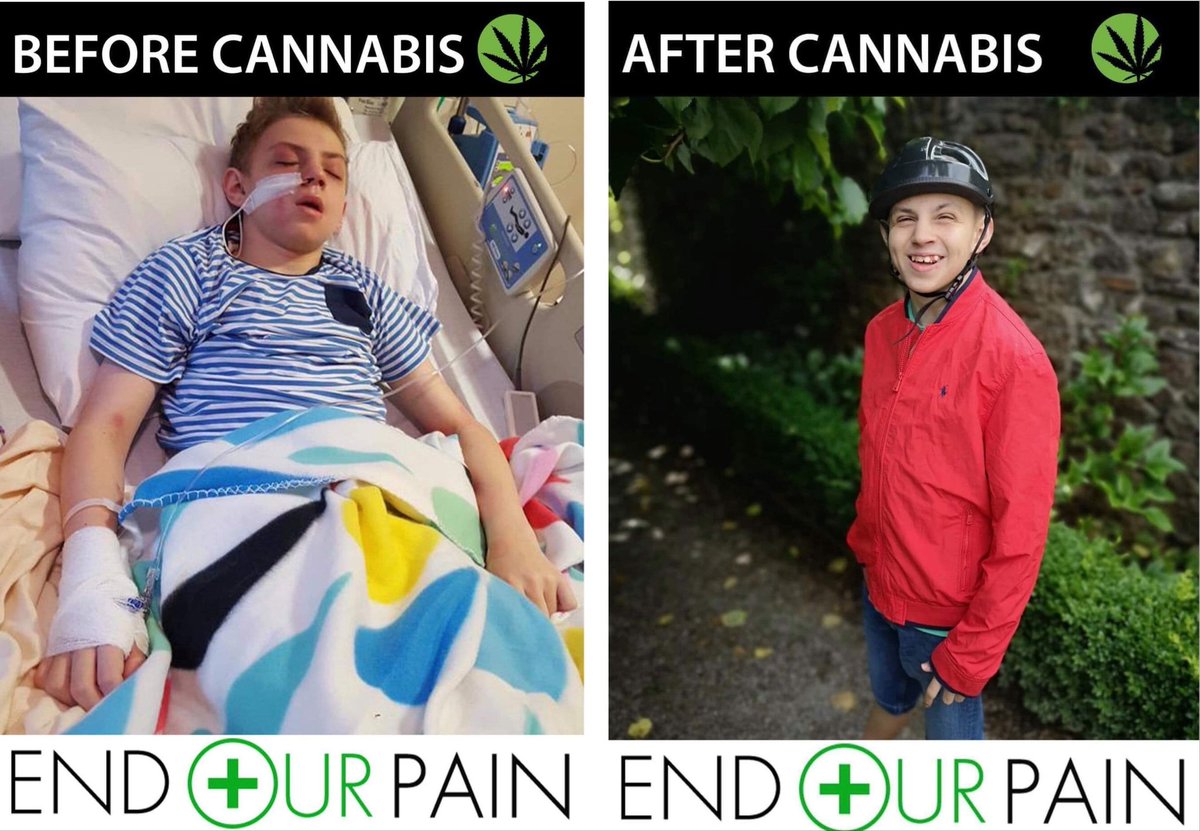 BaileysShakes's tweet photo. Bailey B4 feco wkly hospital stays, fornightly loading of drugs with horrific side affects,No Life Bed Ridden with 100s daily seizures.Bailey aftr feco Seizures Reduced,No hospital stays,no loading of drugs able to Walk Talk Play Interact,has A Quality Of Life. Why deny him this? https://t.co/ADsl7bvlY4