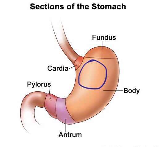 I hereby move that this much more woke region just distal to the cardia be named the Cardi B. #medtwitter #CardiB #endoscopy