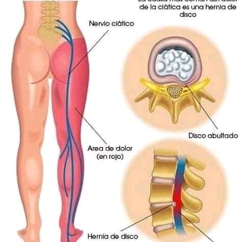 SLuis31's tweet photo. #Terapia #Fisica #rehabilitation  y #Masajes  además aplicación de #Kinesiotape a domicilio o en los nuestros aquí en #CdVictoria  8662378667 https://t.co/UwuE5FUzdt