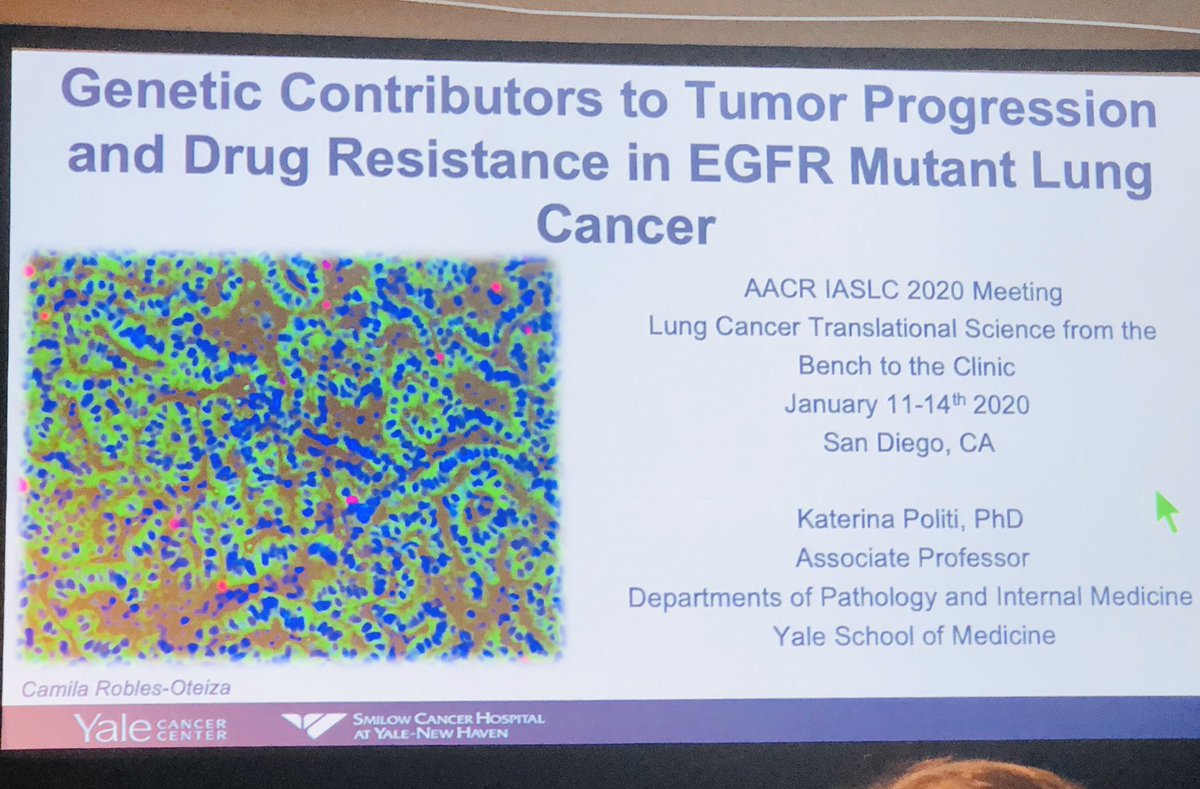 Elegant science and beautiful talk by @politikaterina at #lung20 on role of secondary mutations in EGFRmu lung cancer with regard to progression and drug resistance.  #lcsm