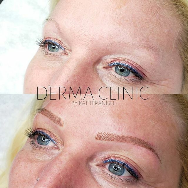 DermaClinicBC's tweet photo. Feeling the fluff! These brows are thin but mighty. My lovely client likes thinner brows so we went pretty conservatively.  This way she won't feel overwhelmed by eyebrows. .
.
➡️ Thick or thin, that's your preference. 
Technique: Soft Combo brow
Artist: Kat
.
.
👉  For more … https://t.co/Dhy9b9IJ79
