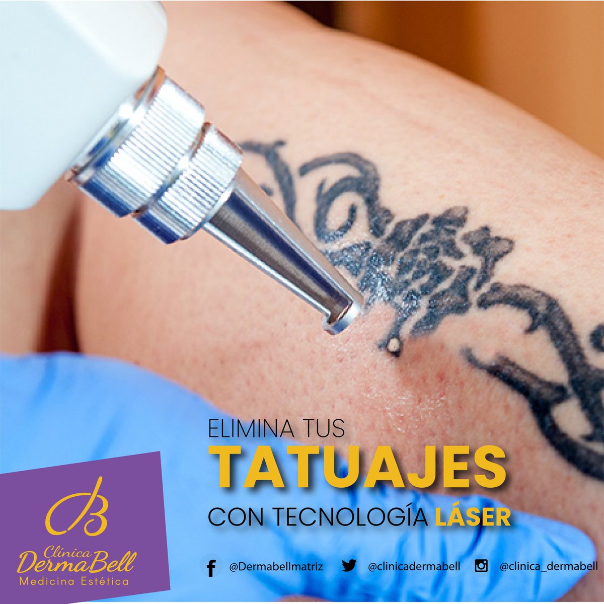 dermabellmx's tweet photo. Con nuestro nuevo tratamiento para eliminar tatuajes #NDYag Láser de Clínicas #DermaBell, olvídate del dolor y no necesita de recuperación. 

¡Elimina todo tipo de tatuajes!

✅Más rápido 
✅Más preciso 
✅Mejores resultados 

¡Reserva ahora en cualquiera de nuestras clínicas! https://t.co/uZAcjRuPLI